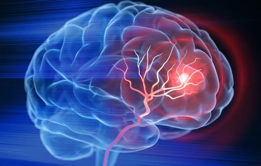 5 Surprising Factors That Could Increase Stroke Risk in Younger Adults
